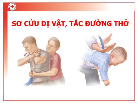 Tài liệu hướng dẫn cách phòng chống tai nạn thương tích, đuối nước - Bài 3: Sơ cứu dị vật đường thở